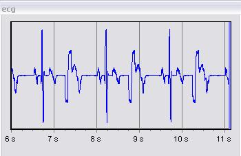 Enhancer ECG